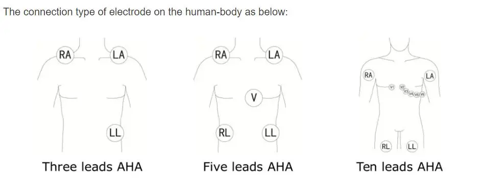 สายนำคลื่นไฟฟ้าหัวใจ 5-lead สำหรับ philips digitrak บวก 24 ชั่วโมง holter 3100A, 5-lead, Snap